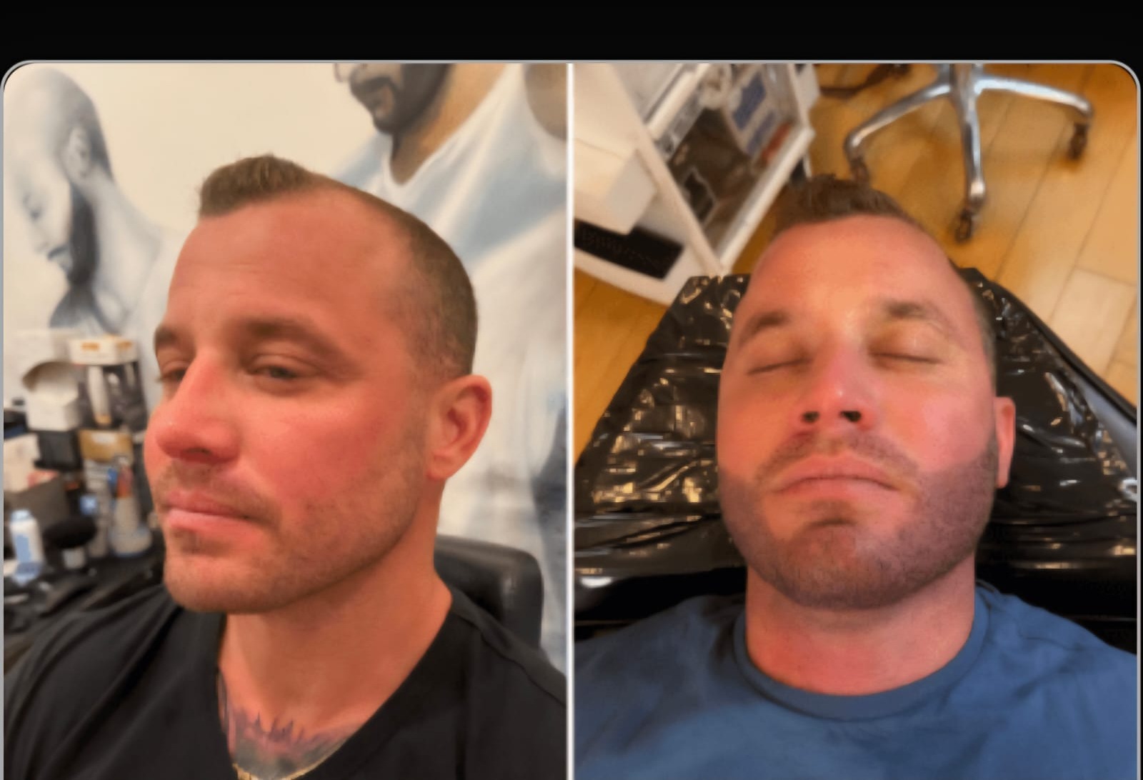 SMP före och efter