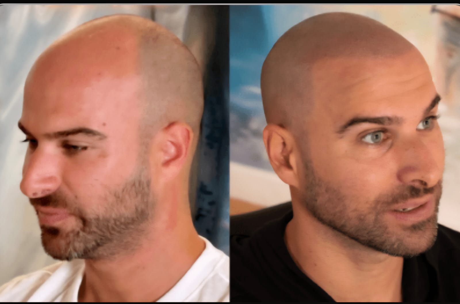 SMP före och efter